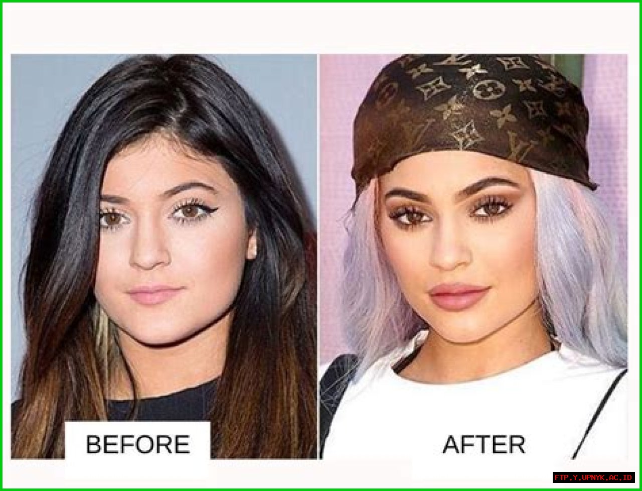 The Ultimate Guide To Kylie Kardashian's Weight Transformation