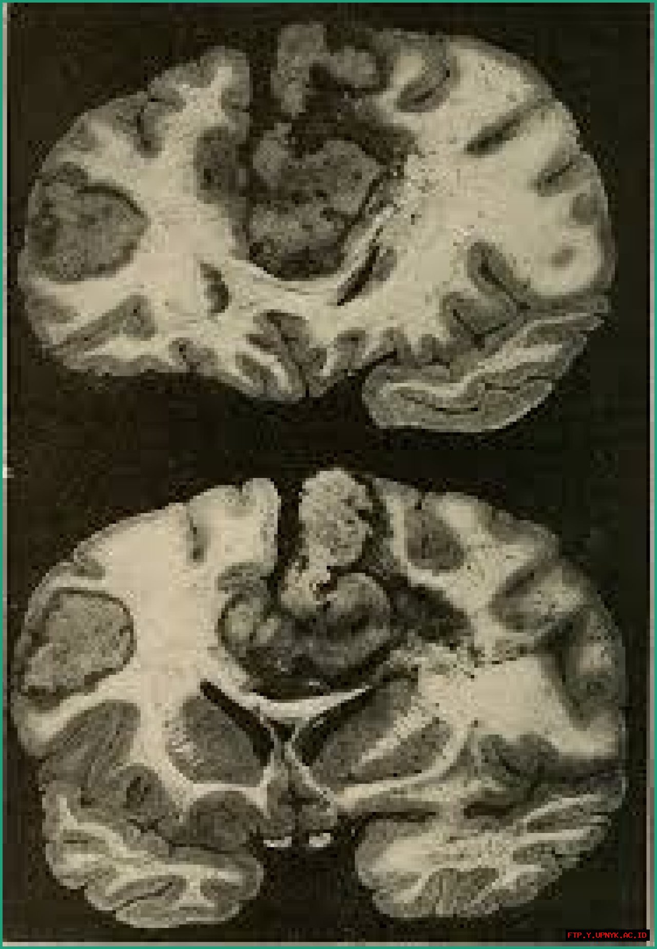 The Ultimate Guide To Understanding Alexia