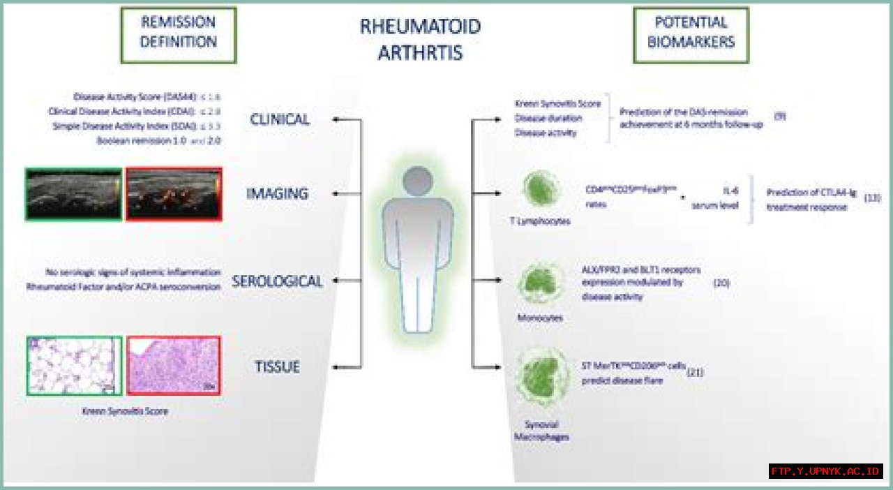Top-Rated Larry Bidelspach's Insights And Legacy
