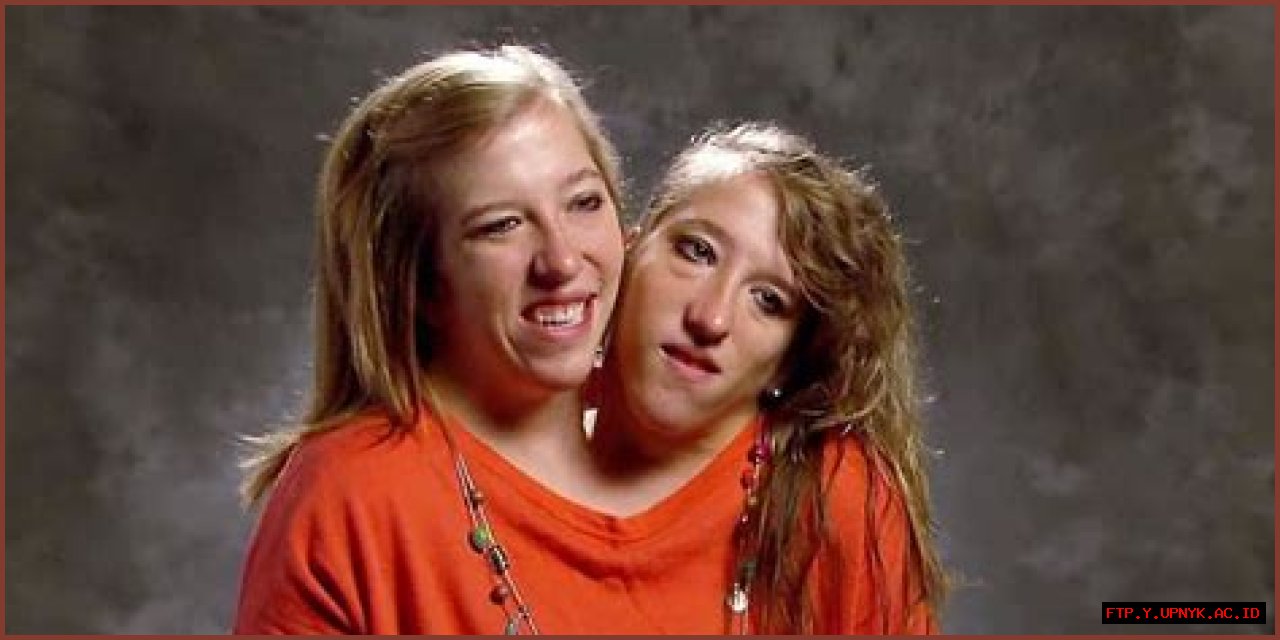Twin Sisters Abby And Brittany Hensel Tie The Knot: A Story Of Love And Triumph