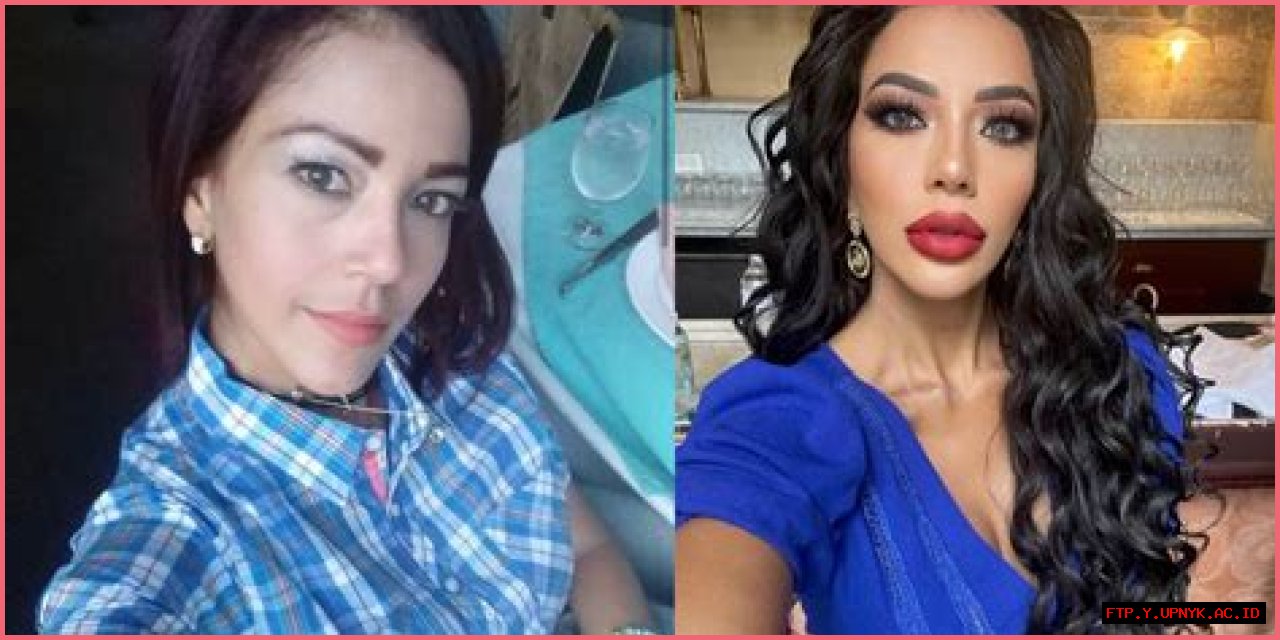 Ultimate Guide: '90 Day Fianc' Plastic Surgery Transformations Before And After