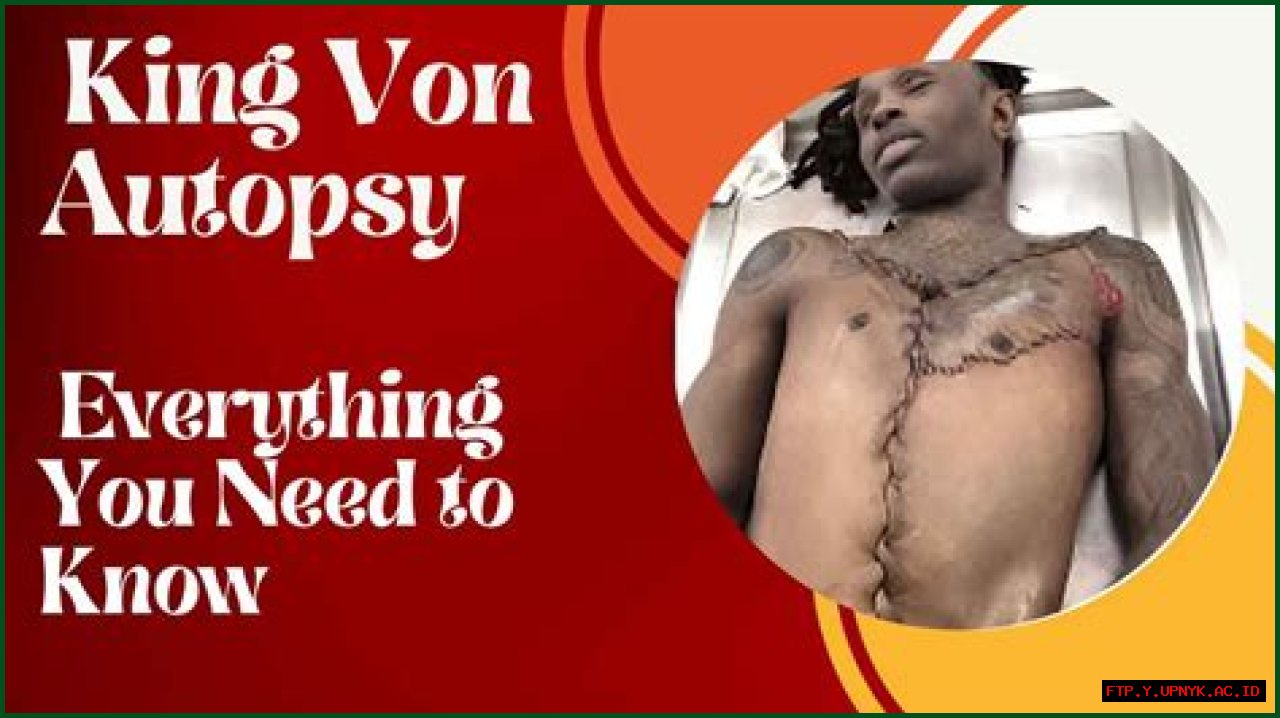 Uncovering The Truth: King Von's Autopsy Image