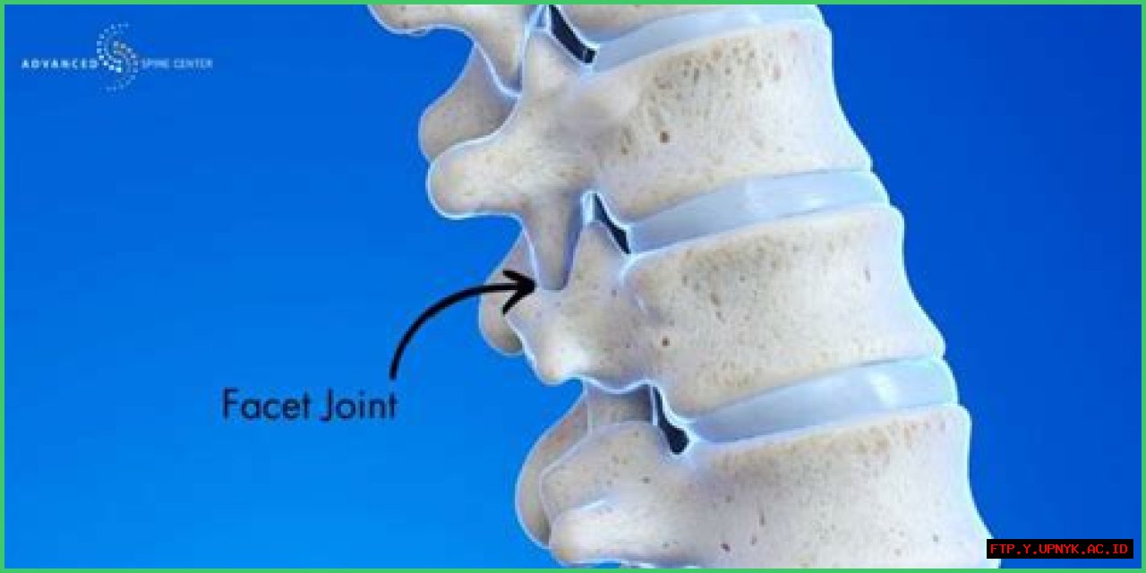 Understanding Facet Hypertrophy: Mild Concerns And Management