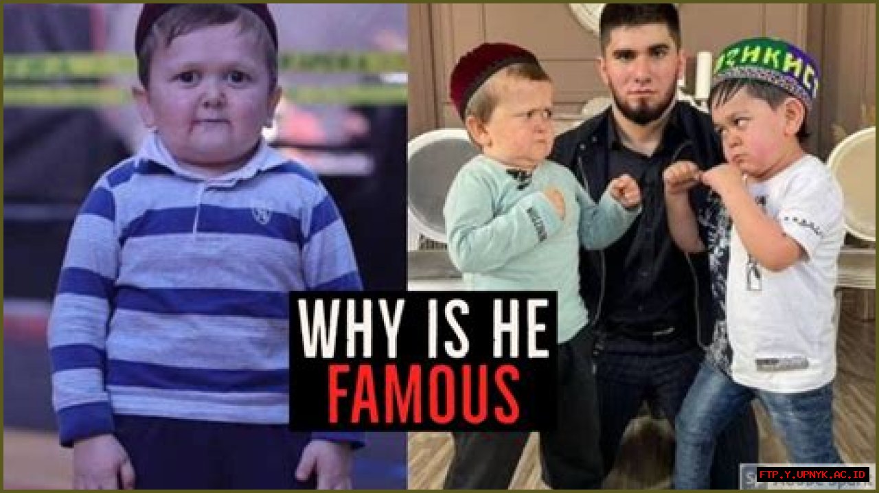 Understanding Hasbulla Syndrome: A Deep Dive Into The Phenomenon