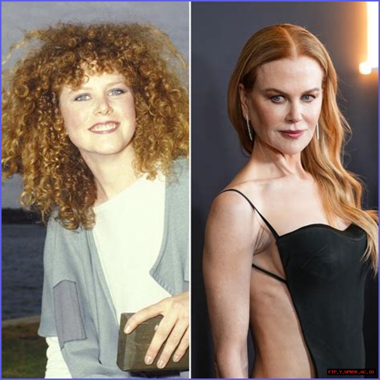 Unmasking The Transformation: Nicole Kidman's Journey With Plastic Surgery