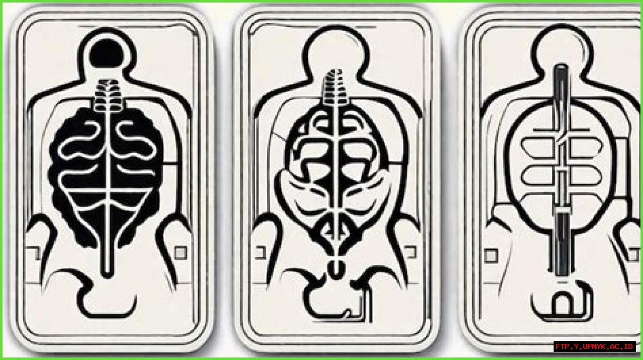 Unraveling The Mystery Of Tarrare's Autopsy Organs