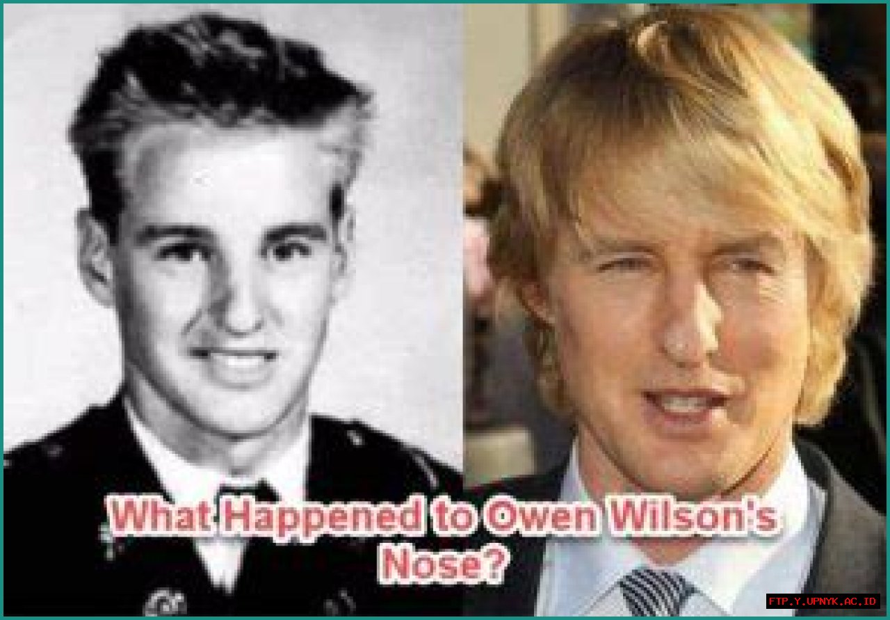 Unraveling The Mystery: Owen Wilson And His Nose