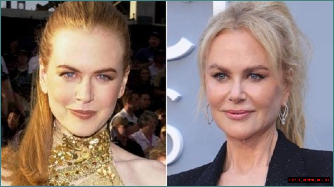 Unraveling The Truth Behind Nicole Kidman's Anorexia: A Journey Of Struggles And Triumphs