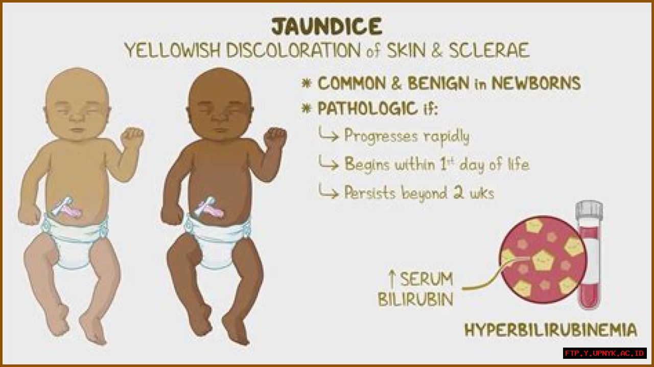 Unveiling The Enigma Of 'Chris Rock Jaundice': A Treasure Trove Of Medical Insights