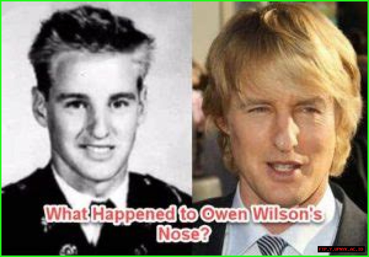 Unveiling The Fascination: Owen Wilson's Nose