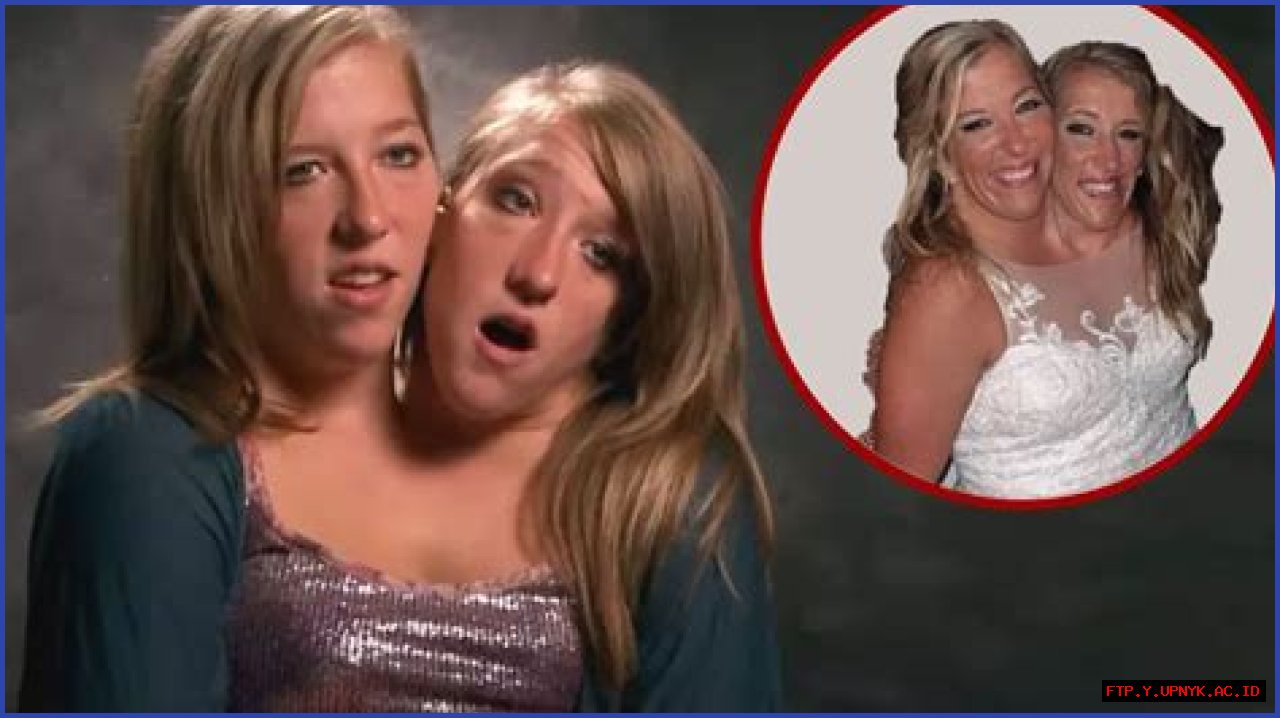 Unveiling The Remarkable Net Worth Of Brittany And Abby Hensel