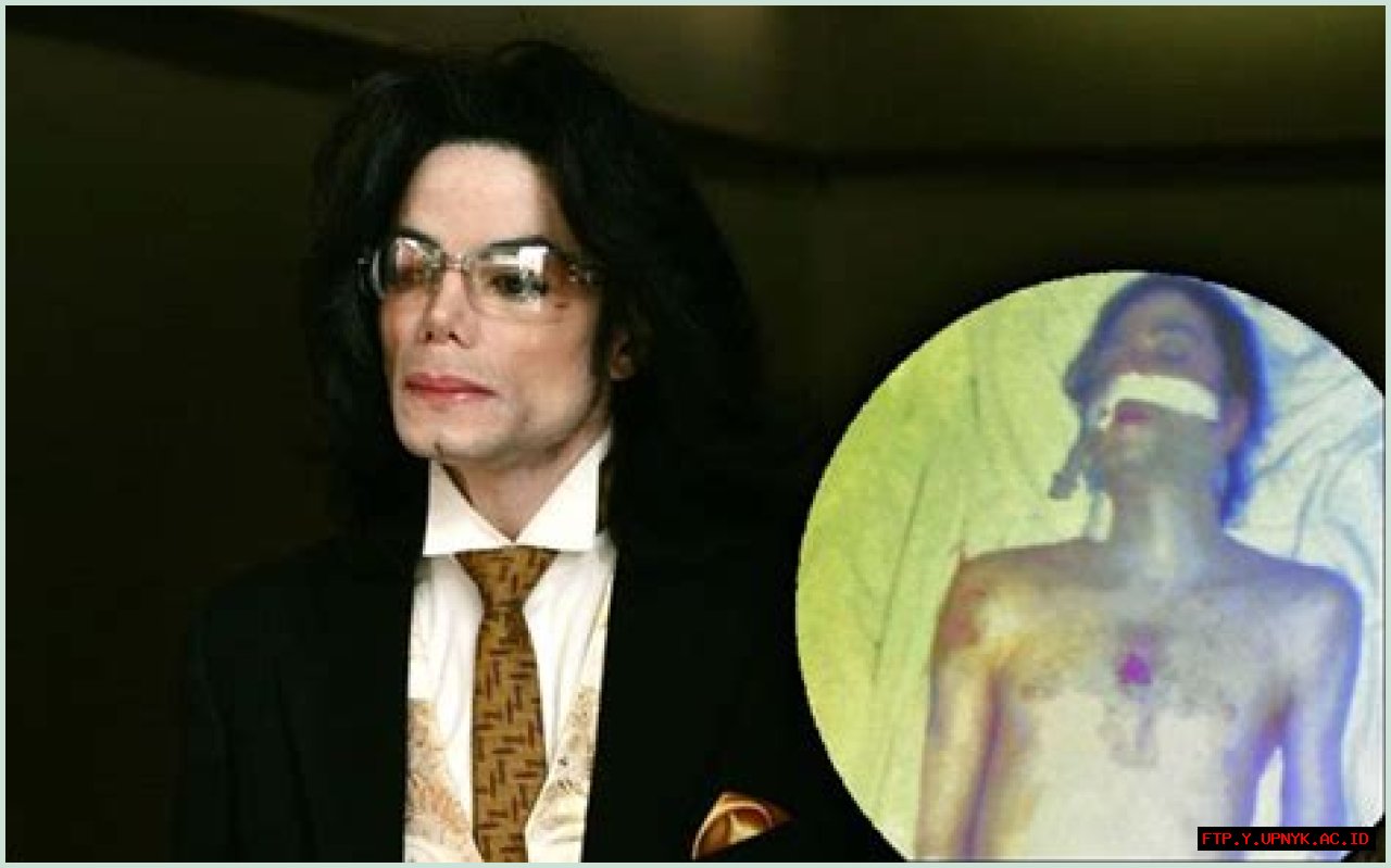 Unveiling The Secrets Of Michael Jackson's Autopsy Report