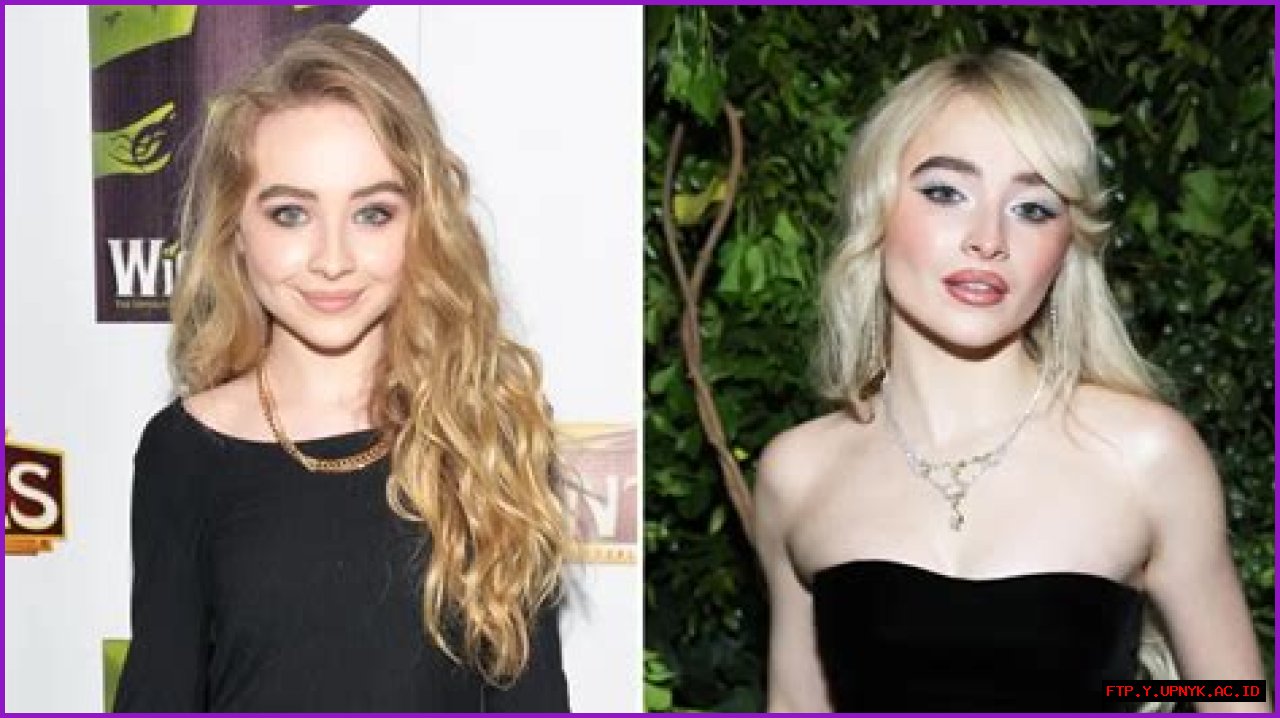 Unveiling The Truth: Does Sabrina Carpenter Have Botox?