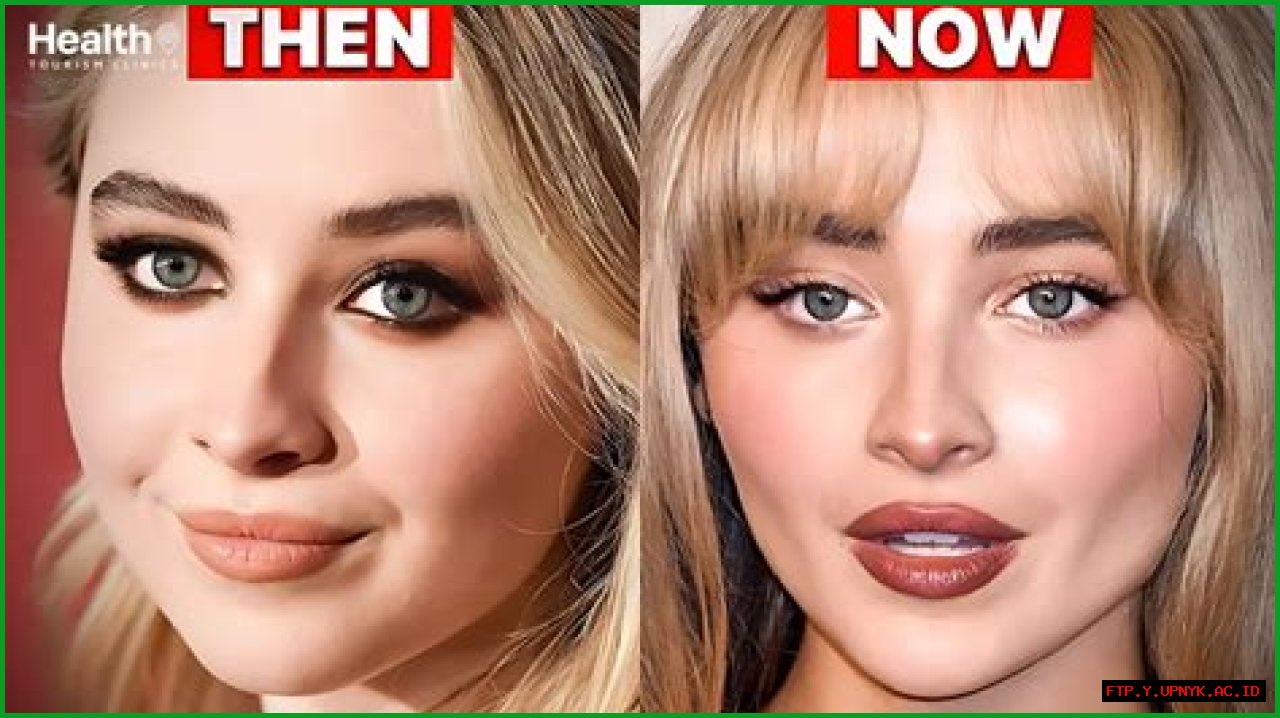 Unveiling The Truth: Has Sabrina Carpenter Got Plastic Surgery?