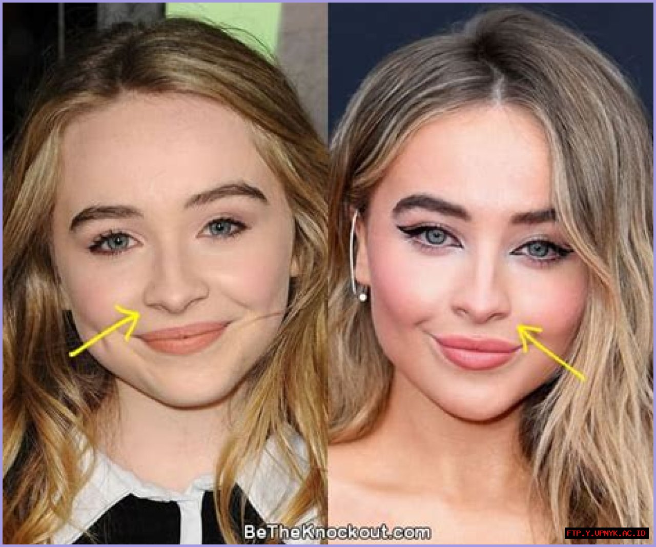 Unveiling The Truth: Has Sabrina Carpenter Had Work Done?