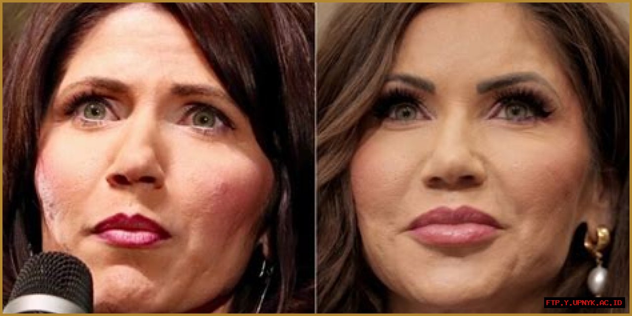 Unveiling The Truth: Kristi Noem's Cosmetic Surgery Journey