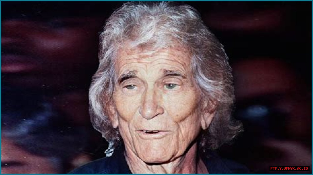 Unveiling The Truth: Michael Landon's Tragic End And Medical Insights