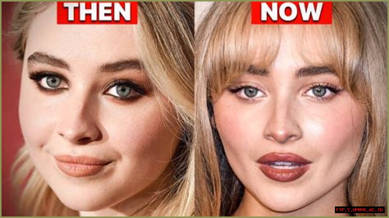 Unveiling The Truth: Savrina Carpenter Surgery And Her Journey