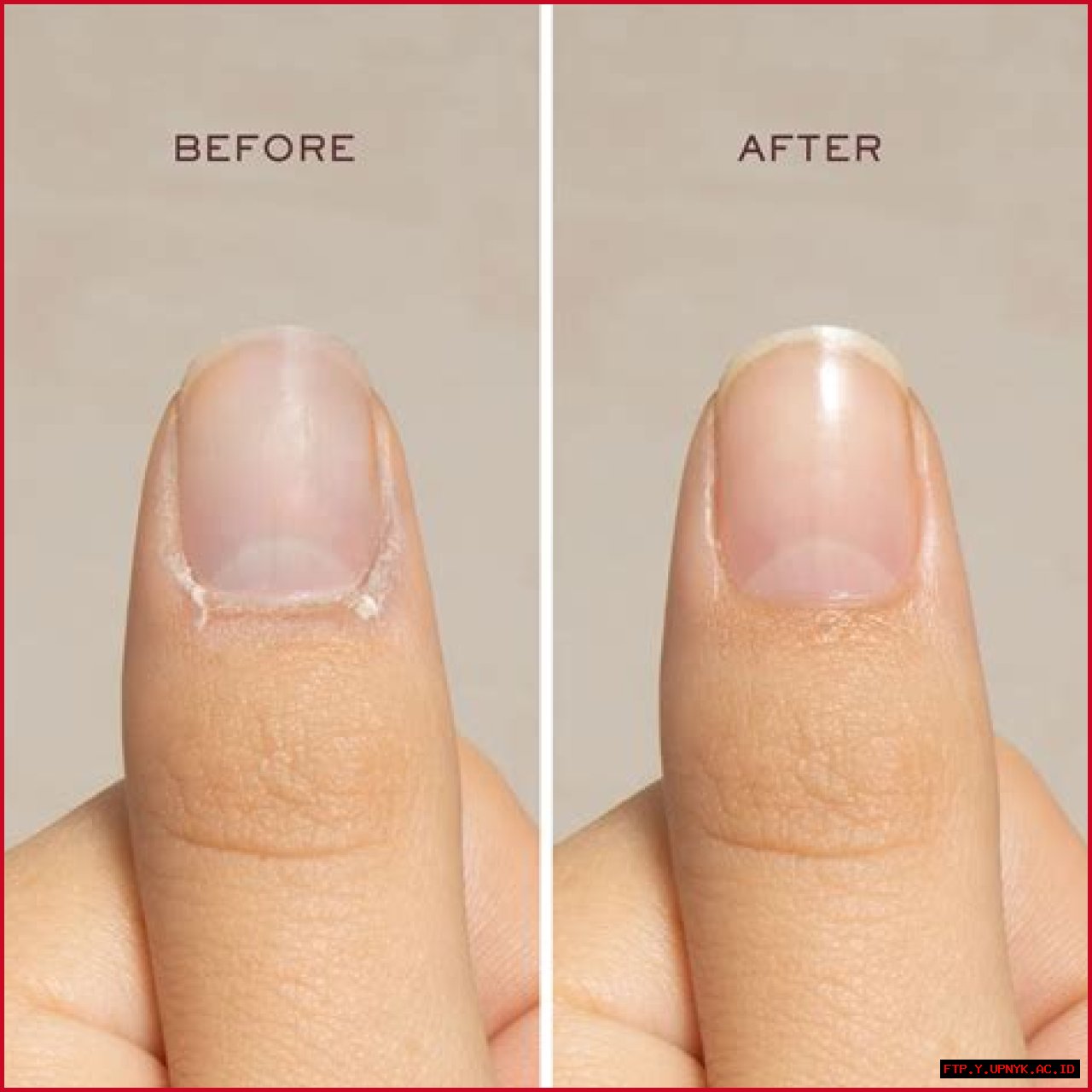 Upgrade Your Nail Care: Discover The Best Cuticle Cream For Healthy, Hydrated Cuticles