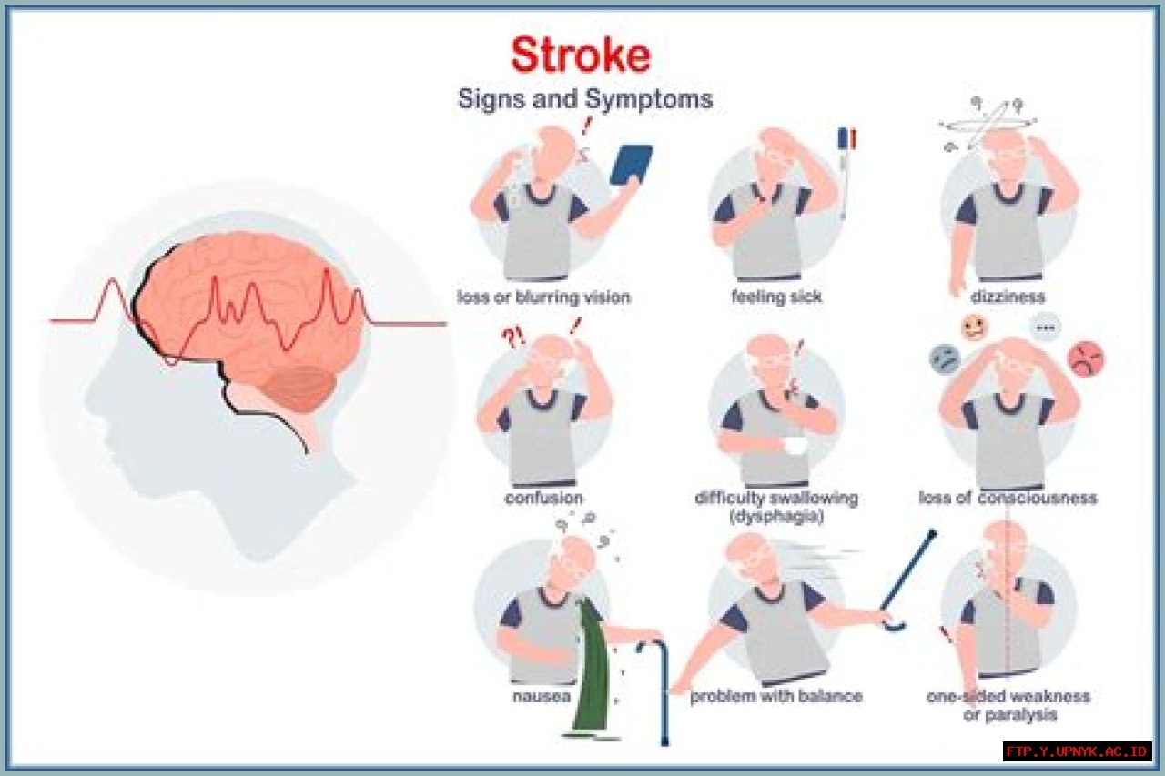 Warning Signs: Leigh Keno's Stroke Symptoms And Treatment Options