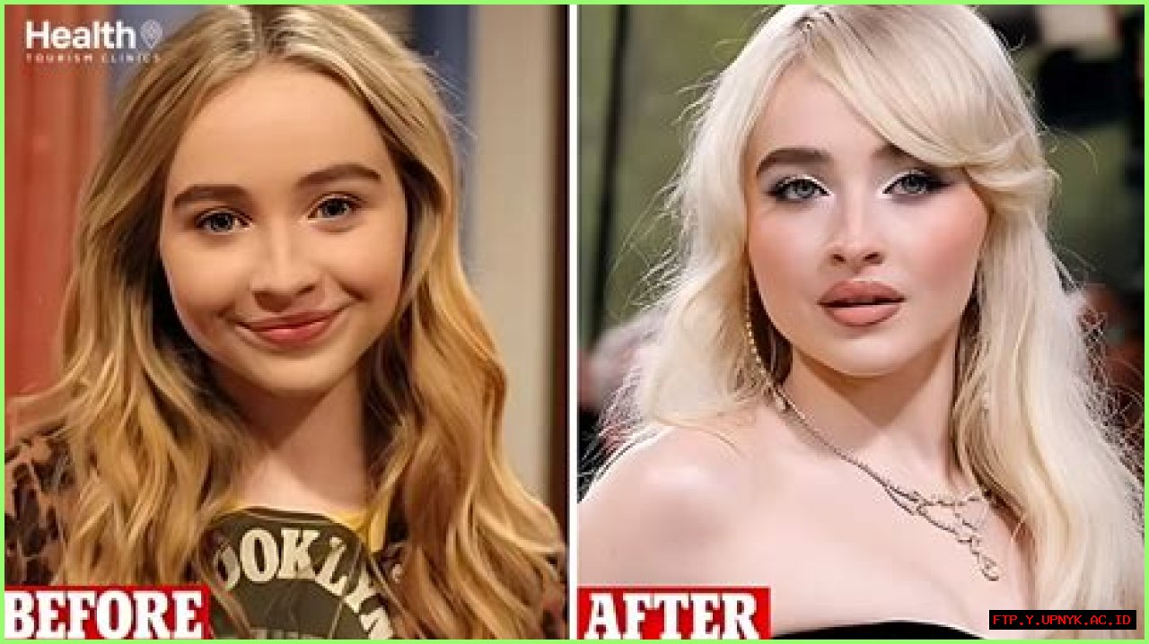 What Cosmetic Procedures Has Sabrina Carpenter Undergone?