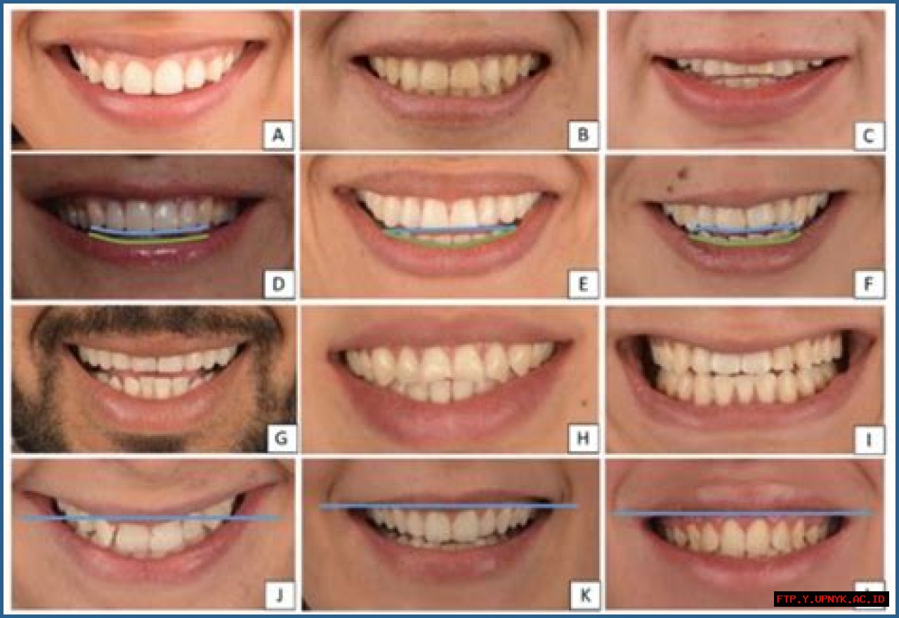 Your Perfect Smile Awaits With Bway Smiles