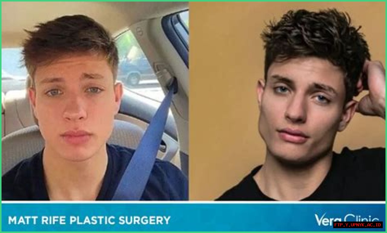 Zach Braff's Weight Loss And Plastic Surgery: A Transformation Explored